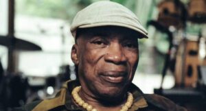 Milton Nascimento e a Demência por Corpos de Lewy: Entenda a Doença